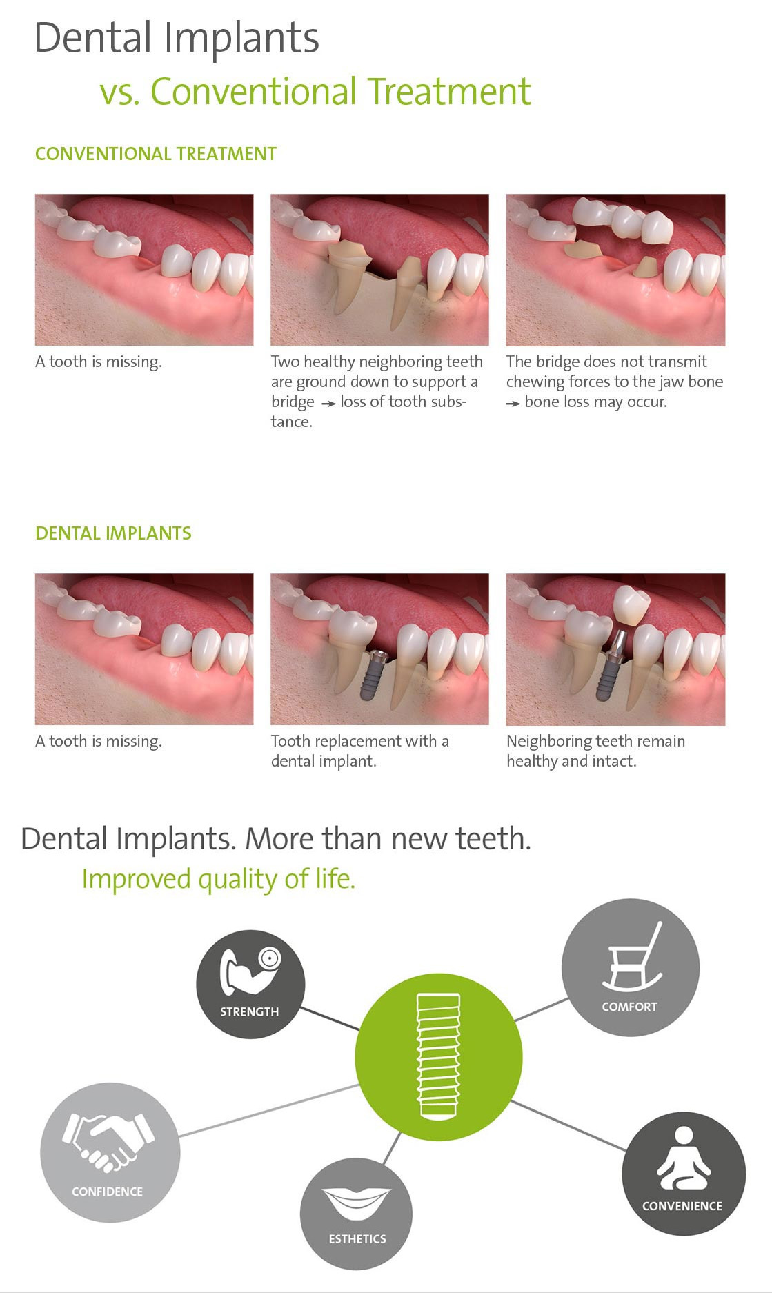 Bay-2-Dental-implants-V39s-conventional-implants-Bay-3-Dental-Implants-more-than-new-teeth-